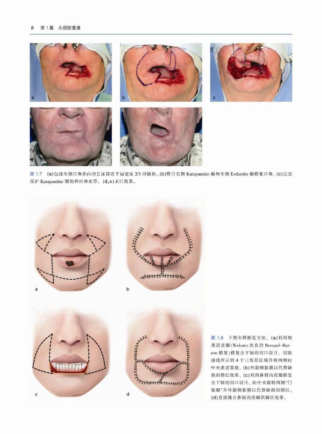 最新整容技术，重塑美丽的无限潜能